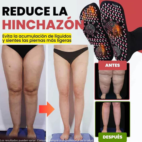 (¡Llévate 2 pares por el precio de 1!) Calcetines de Acupresión Anti-Várices