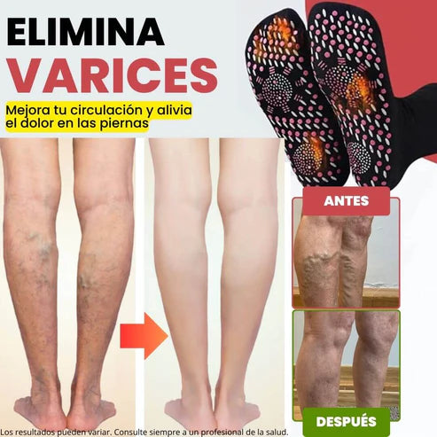 Calcetines de acupresión Anti-Varices (Compra 1 par y llévate 2 pares)